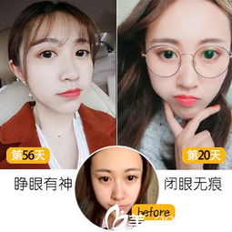 魏晓峰 个人主页 深圳易容颜整形 美佳网