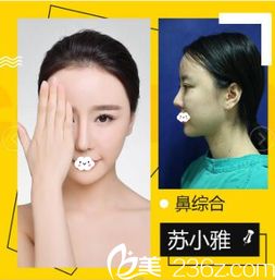 深圳鹏爱秀琪医疗美容整形医院口碑怎么样 案例 医生 优惠价格 美佳网