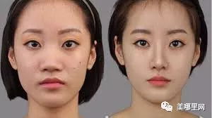 学生群体现 整容热 当心 微 整形变 危 整形