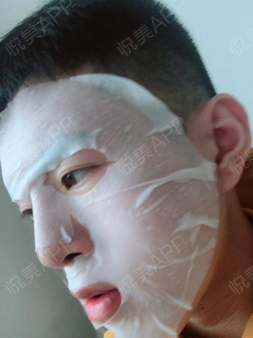 不知不觉里,时间过去两...面部填充 悦美整形