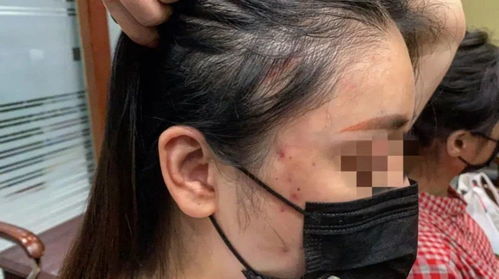涉案6400余万 60多家无证医疗美容诊所被查处 产品流向全国各地