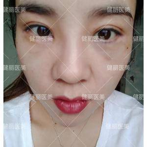 逆时针整形 上海健丽医疗美容门诊部怎么样 正规吗 地址 悦美整形