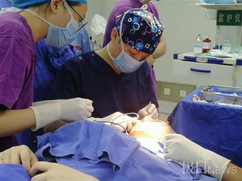 医美热潮下,医生资质不清 产品真假难辨等问题,爱美人士做决定前可预设冷静期