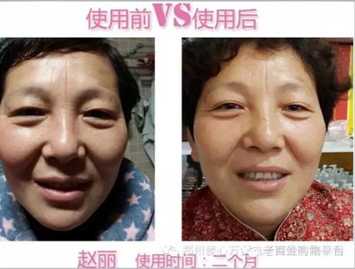 瑞蓝之泉活化能精华液 细胞美容液态整形产品