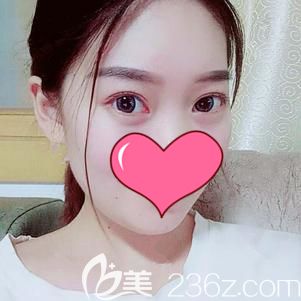 武汉艺星医疗美容门诊部 整形案例 美佳网